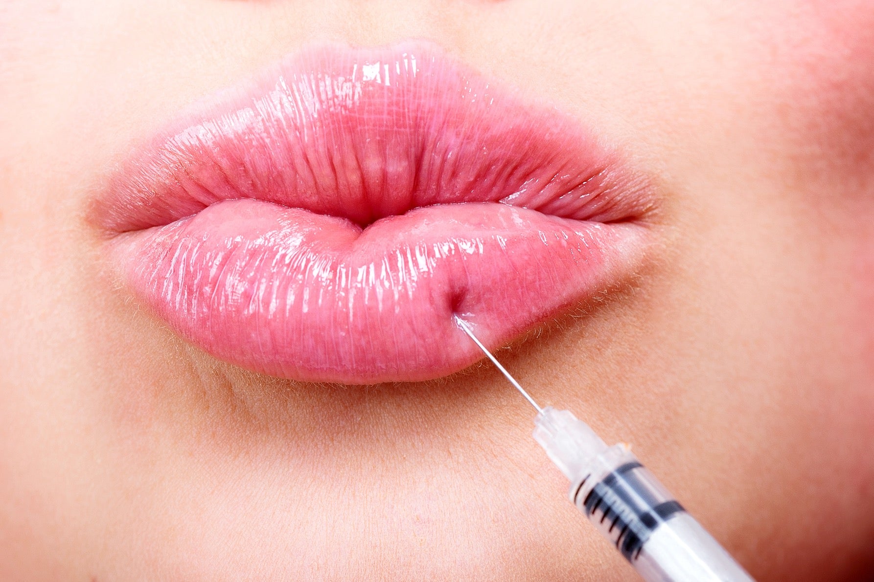 Dermal Filler Treatments