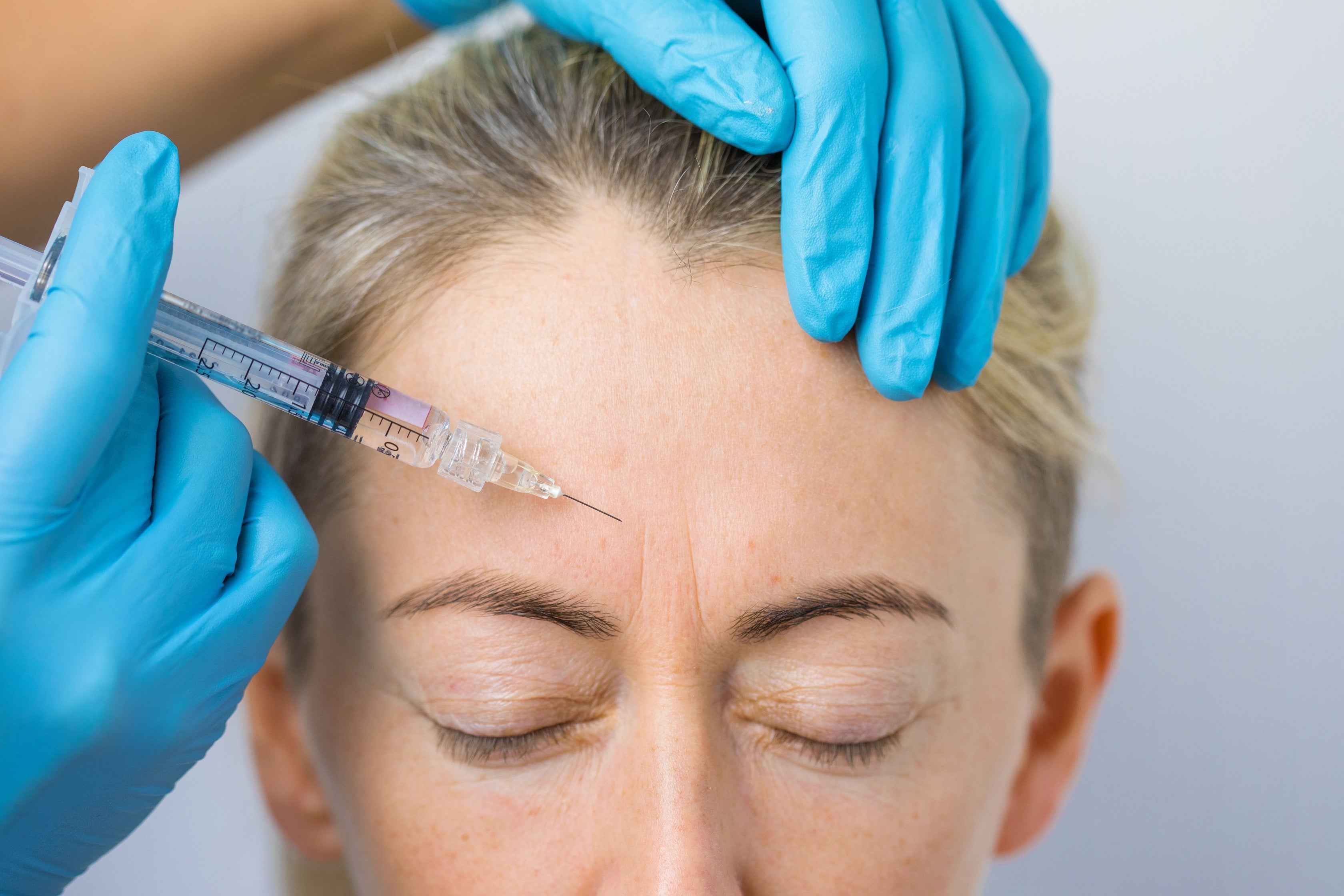 Anti-Wrinkle Injections